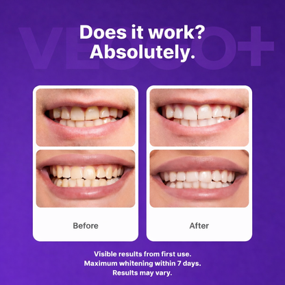 Vesco Purple Whitening Strips